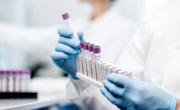 AIS Biotech lève 1,5 million d'euros pour développer son spray nasal à base de sucres pour lutter contre la grippe.