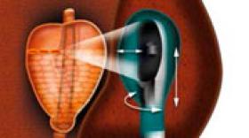 Bref 2149 : Cap innovation - Edap TMS : l’innovation comme moteur 
