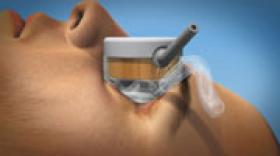 EyeTechCare installe son dispositif dans quatre hopitaux en France