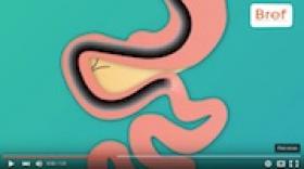 VIDEO. Saga #BrefInnov 3/12 : Horuscare