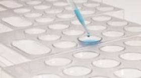 L’Institut de biologie et de chimie des protéines s’agrandit