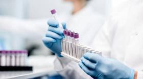 AIS Biotech lève 1,5 million d'euros pour développer son spray nasal à base de sucres pour lutter contre la grippe.