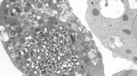 Amoéba procède à une deuxième levée de fonds