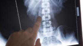 Spineway en forte hausse