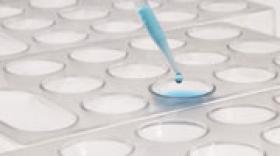 iDD Biotech lève 1,5 million d’euros