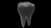 Biotech Dental acquiert une participation majoritaire au sein de Denteo