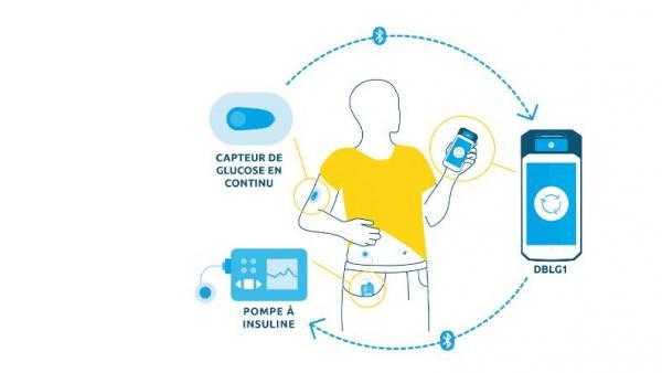 Nouvelle levée de fonds pour Diabeloop dans la gestion du diabète