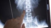 Spineway en forte hausse